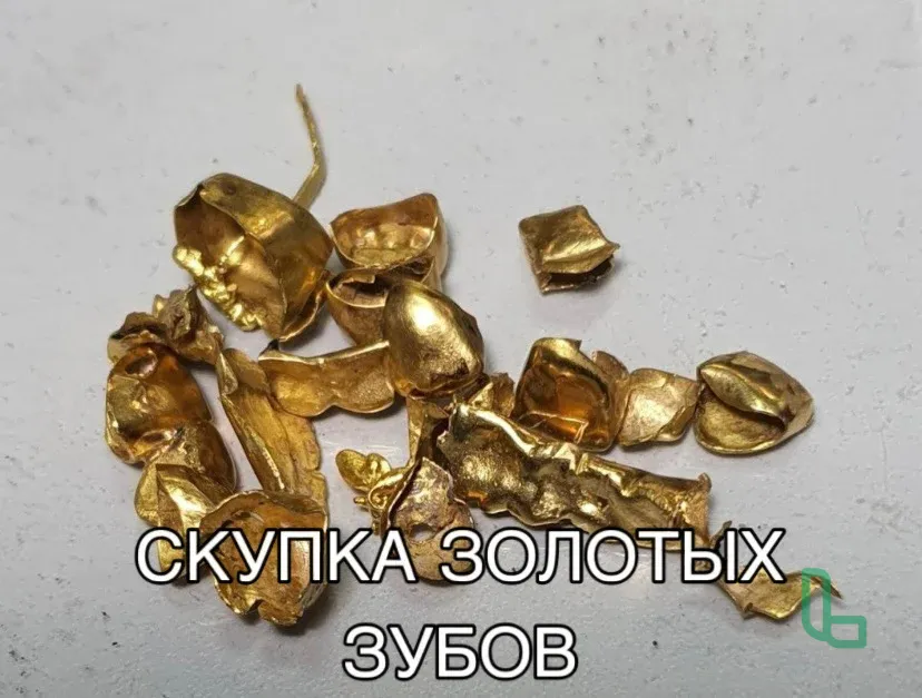 Скупка Продажа Золотые Зубы, Зубные Коронки, 750
